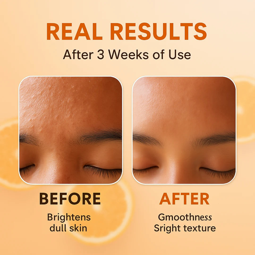 10% Vitamin C Face Serum with Ferulic Acid – Brightening Serum for Glowing Skin, Dark Spot Corrector, Anti-Aging & Even Skin Tone – Suitable for All Skin Types-(30ml)