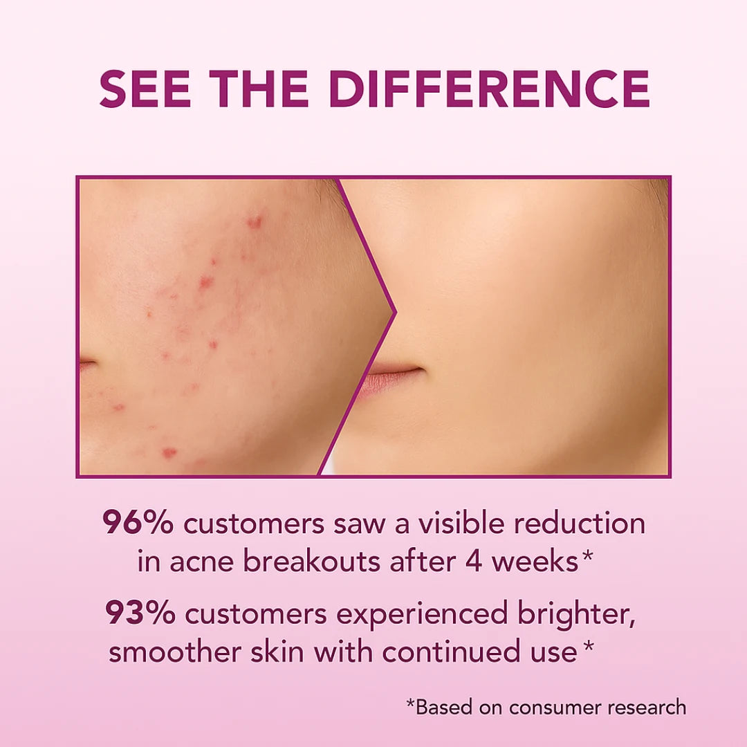 5% Niacinamide With 2% Rice Water Face Wash |  Treats Active Acne & Fades Acne Marks | Face Wash for Tan Removal, Clear and Bright Skin & Glowing Skin | Korean Skincare -(100ml)